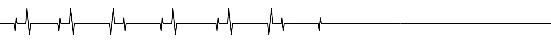Heart beat